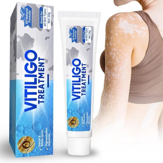 Vitiligo Cream, Vitiligo Treatment for Skin Vitiligo, Vitiligo Care Cream for Reduce White Spots and Improve Skin Pigmentation