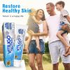 Vitiligo Cream, Vitiligo Treatment for Skin Vitiligo, Vitiligo Care Cream for Reduce White Spots and Improve Skin Pigmentation