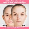 Microcurrent Facial Device, USB Rechargeable Face Massager for Anti Aging and Wrinkle, Intelligent Double Chin Massager